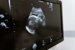 pregnancy scan at fertility specialists office